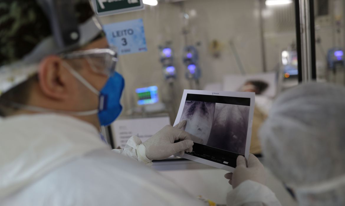 _radiografia_de_torax_coronaviruscovid-19_hospital_sao_paulo1205200326