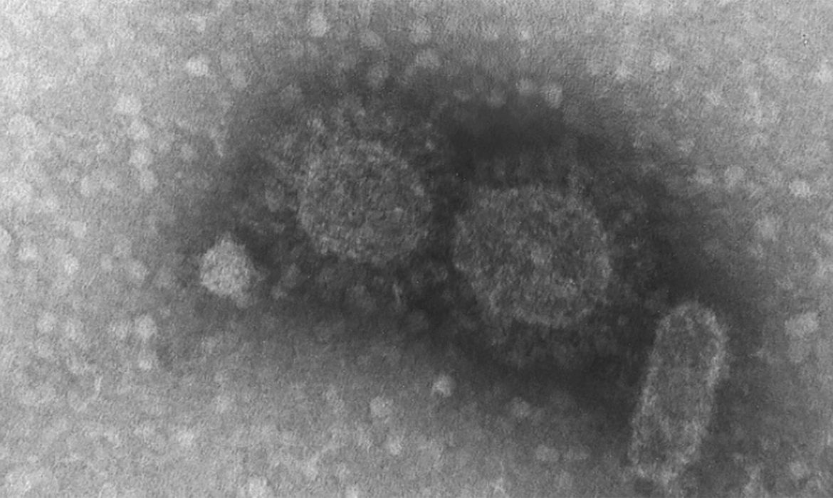 sequenciamento_genetico_do_coronavirus_instituto_adolfo_lutz171220200874