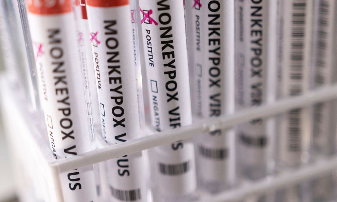 2022-05-23t222423z_1_lynxnpei4m100_rtroptp_4_health-monkeypox_1 (1)
